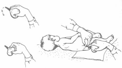 How to make an enema for an infant How to make an enema for an infant