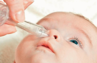 Runny nose in an infant