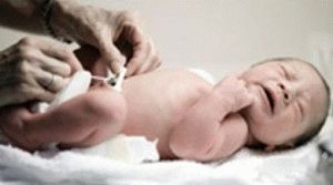 how to treat an umbilical wound