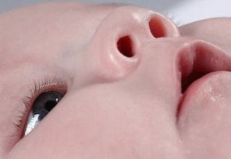 how to instill drops in a newborn baby how to instill drops in a child