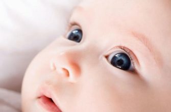 The baby's eye is festering