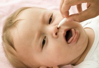 How to clean the nose of a newborn baby from gnats
