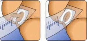 urine collection in the baby by the urinal