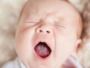 why does a newborn have a white tongue