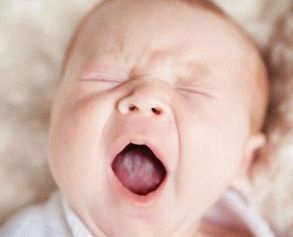why does a newborn have a white tongue