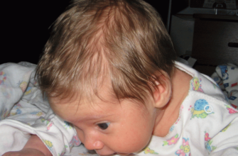 Why does the baby sweat