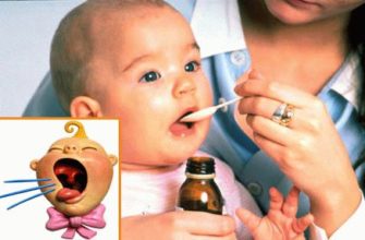 Dry cough in an infant