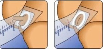 how to collect urine