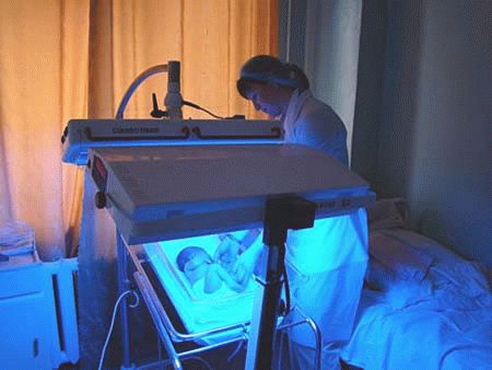 Jaundice Treatment