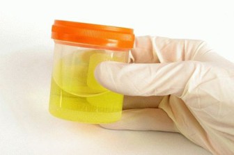 turbid urine in an infant