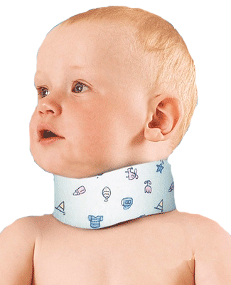 Torticollis in infants