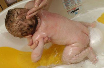 After each act of defecation, it is necessary to wash the baby, dry his skin and treat the folds with talcum powder or baby cream.