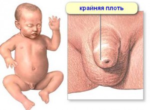 intimate hygiene of newborn boys