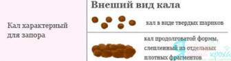 feces characteristic of constipation in newborns