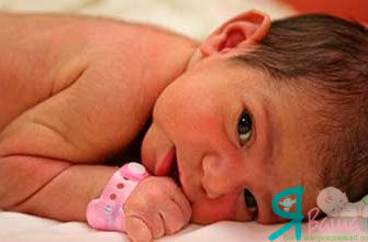 newborn with body hair