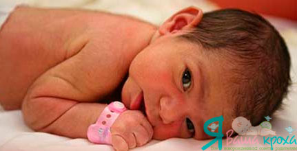 newborn with body hair
