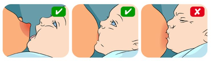 How to apply to the chest