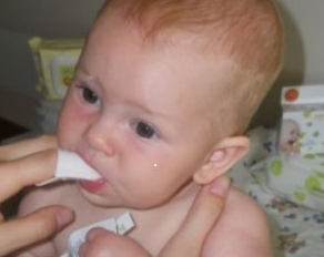 treat thrush in the mouth of a newborn