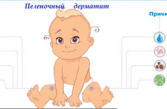causes diaper dermatitis