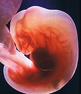 pregnancy 4 weeks