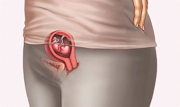 pregnancy is 9 weeks
