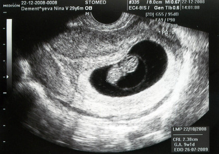 9-week-uzi photo