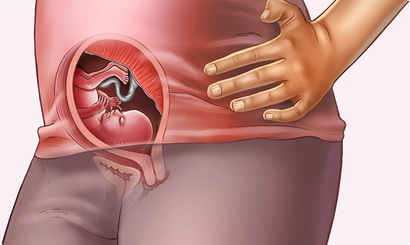 18 week of pregnancy