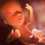 pregnancy-13-week-how-looks-fetus