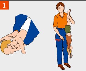 first aid to a child who choked