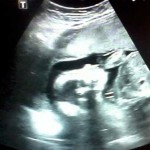 Uzi photo at 21 weeks