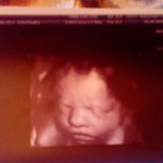 photo-uzi-29-week