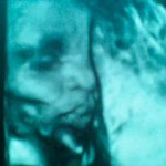 ultrasound