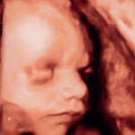 Uzi-29-week-photo