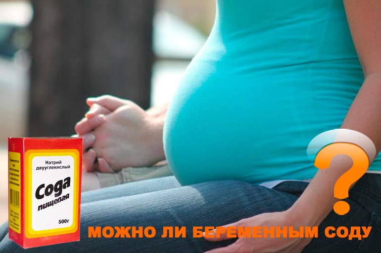 baking soda during pregnancy