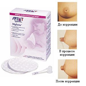 Avent Nipple Corrector