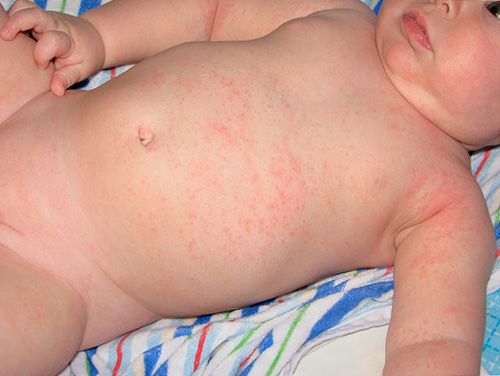 sweating in a newborn
