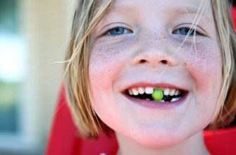 extraction of milk teeth