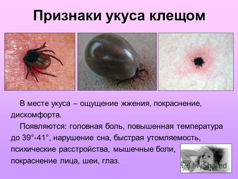tick bite signs