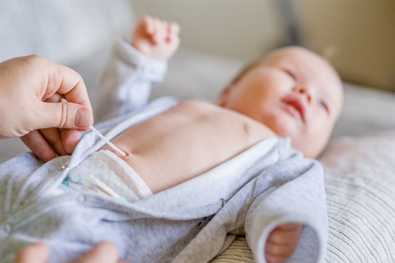 the navel becomes wet in the newborn
