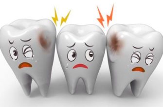 breastfeeding and caries