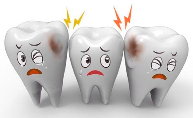 breastfeeding and caries