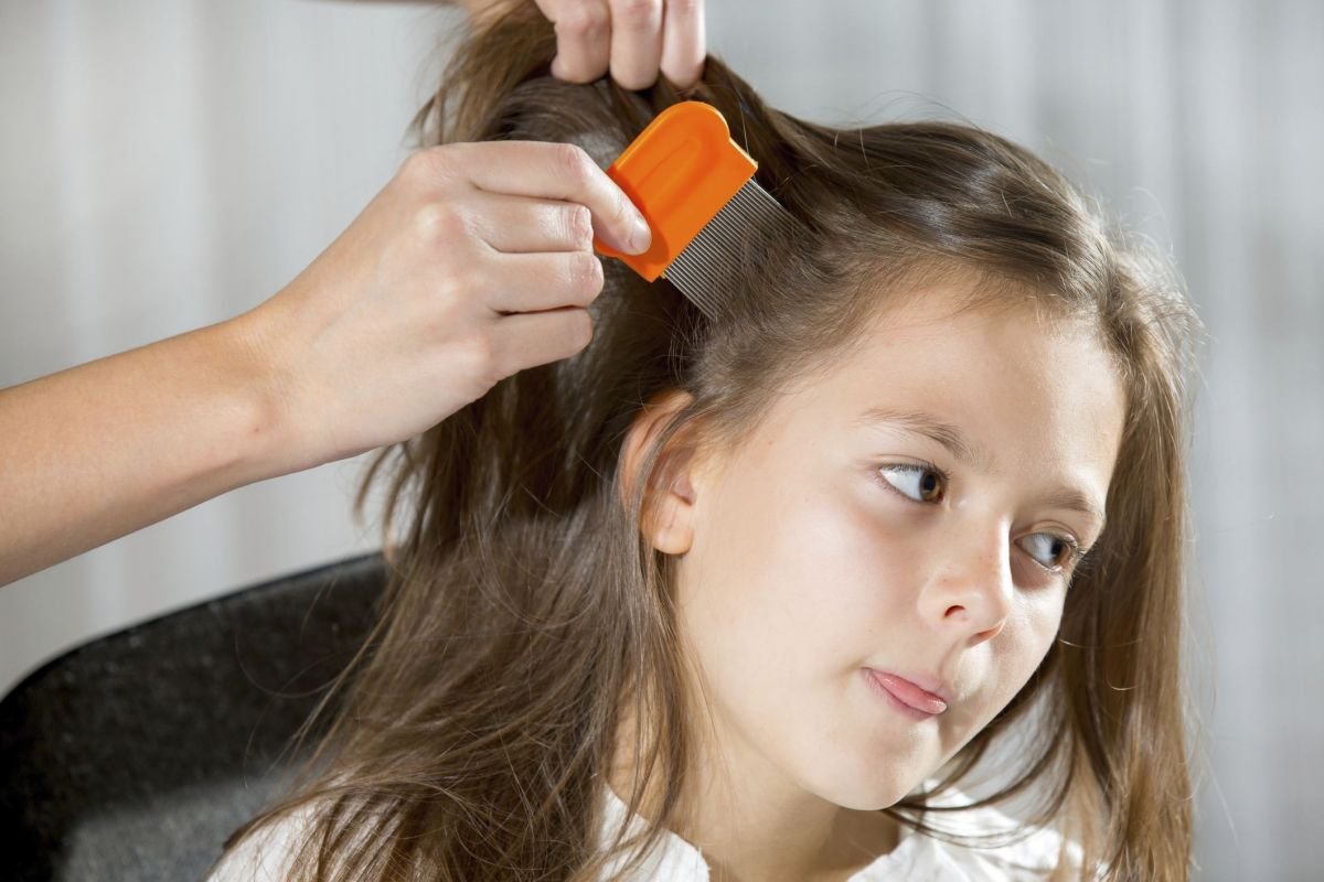 in a child PEDICULOSIS