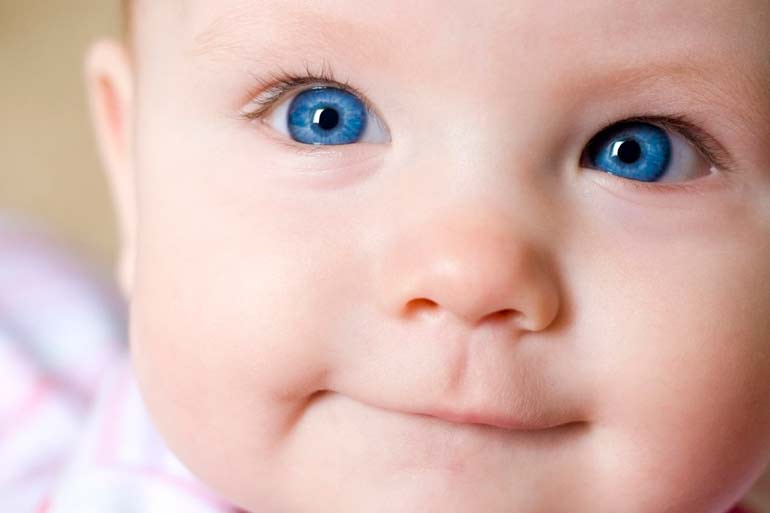 physiological strabismus in a newborn baby
