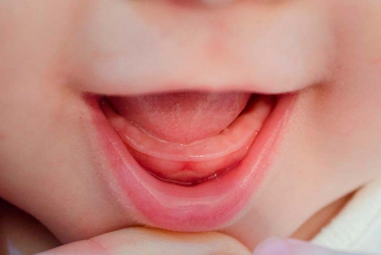 the child’s teeth are being cut